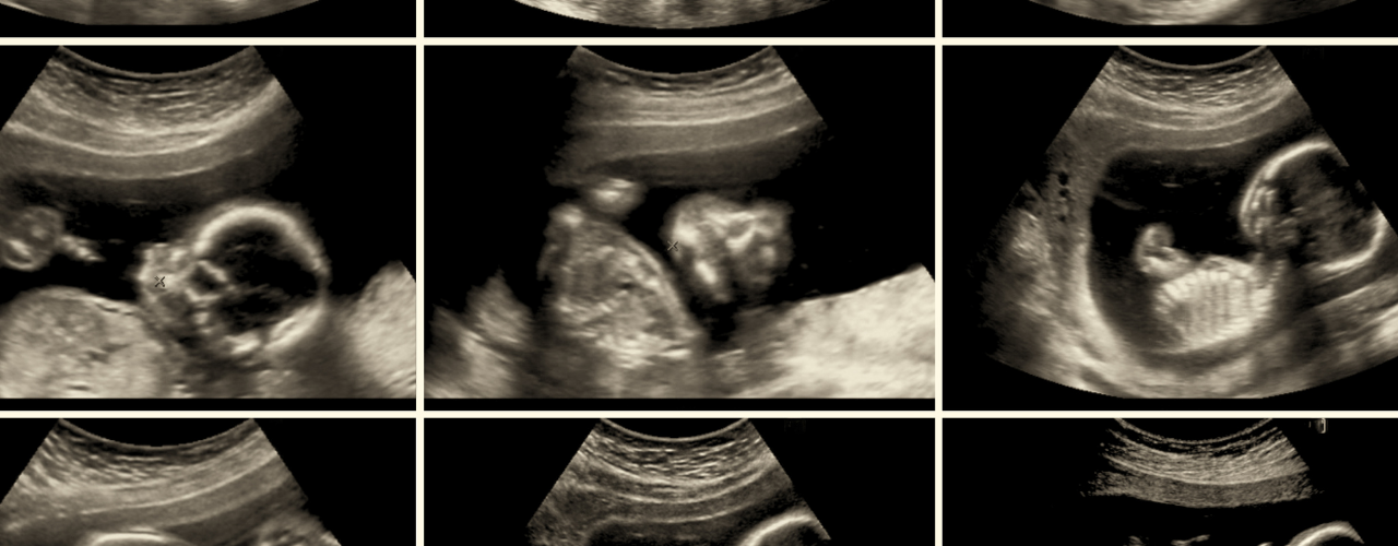 Telex és abortusz