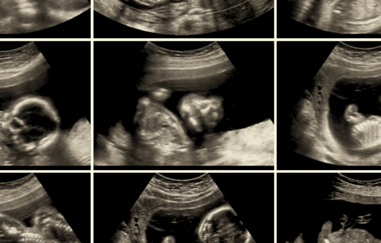 Telex és abortusz